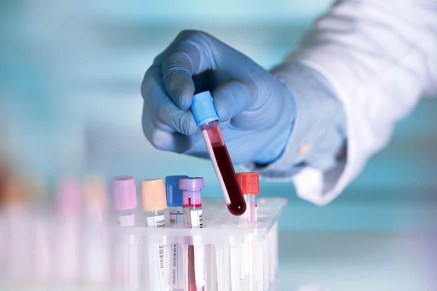 Günstig, schnell und unkompliziert: Für den ABCB1-Test braucht es bloss ein Röhrchen voll Blut.