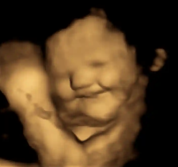 The face of an unborn baby when it tastes a carrot.