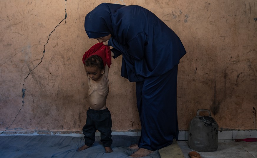 epa12247637 Palestinian child Yazan Abu Foul, aged two, is cared for by his mother Naima, as he suffers from severe malnutrition due to the acute shortage of food caused by the blockade imposed on the ...