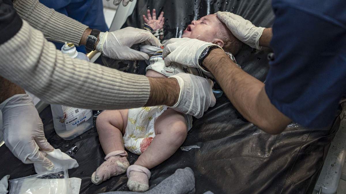 FILE - A Palestinian baby wounded in Israeli bombardment of the Gaza Strip is treated in a hospital in Khan Younis on Dec. 1, 2023. The war in Gaza has sparked a humanitarian catastrophe that has prom ...