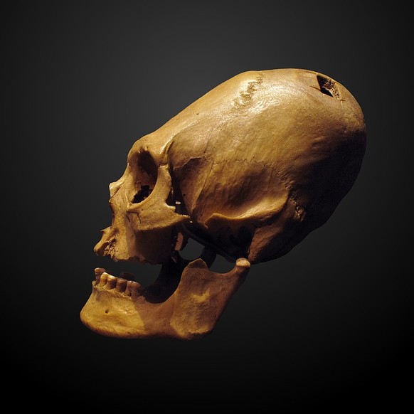 In großer Größe herunterladen900 × 900 px jpg
Im Browser ansehen

Du musst den Urheber angeben

Altperuanischer Schädel der sowohl Deformität als auch Anzeichen von Trepanation aufweist; ausgestellt i ...