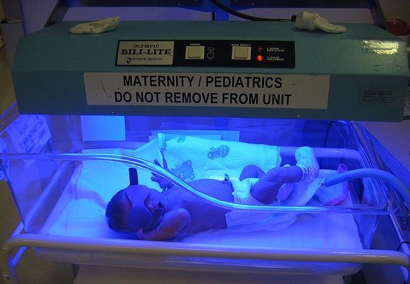 Bisher sieht die Lichttherapie bei Neugeborenen so aus.&nbsp;