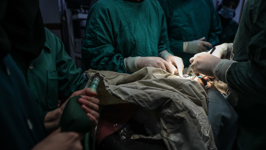 epa06260117 Dr. Husam performs surgery with a consultation from another doctor via a messaging app, with his team at a unit of the Damascus Countryside Specialized Hospital in Douma, Syria, 11 October ...
