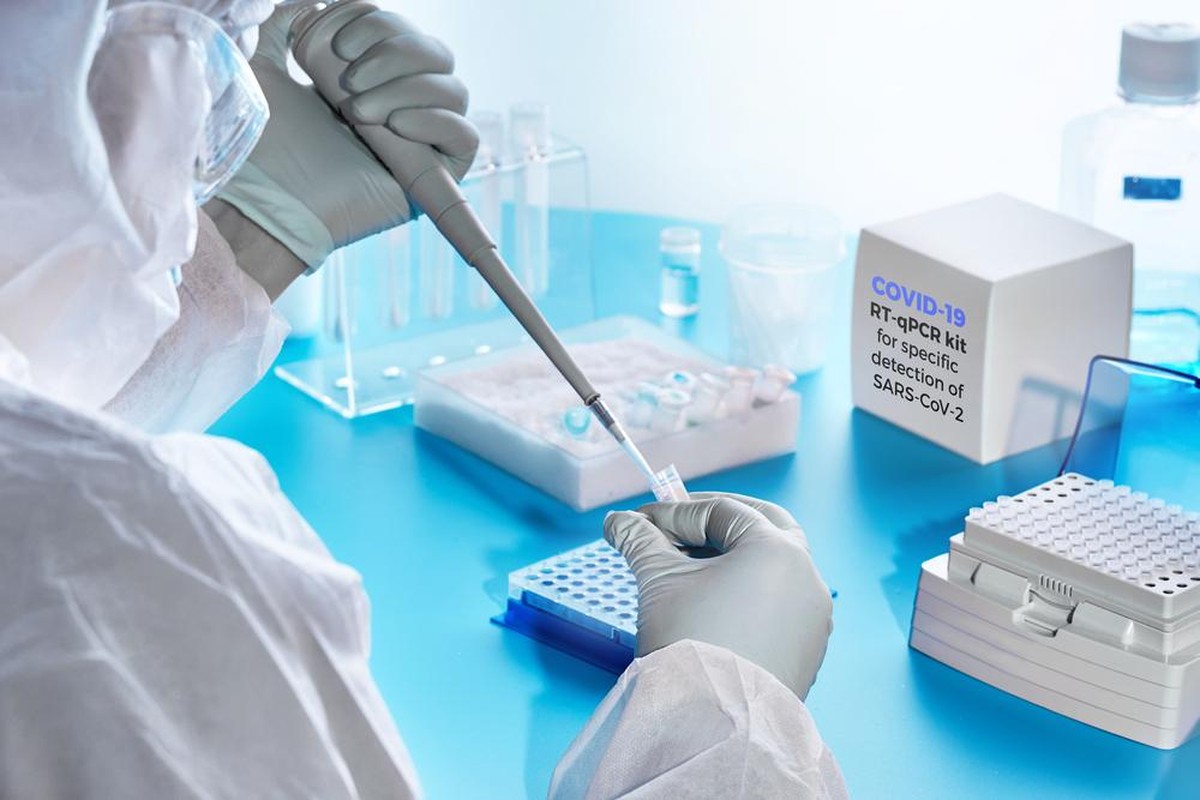 PCR-Test Covid-19, SARS-CoV-2