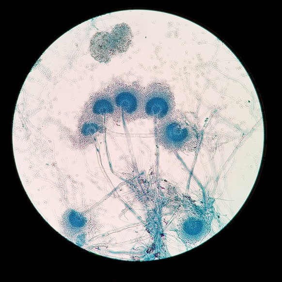 Aspergillus terreus unter einem Lichtmikroskop