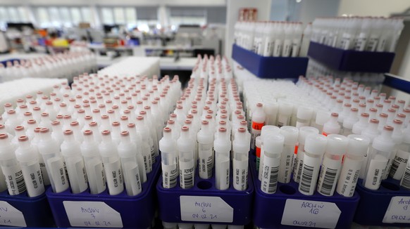 epa08996711 An view of coronavirus tests inside the laboratory at Bioscientia Healthcare GmbH in Ingelheim, Germany, 08 February 2021. The largest medical laboratory in Rhineland-Palatinate, Bioscient ...