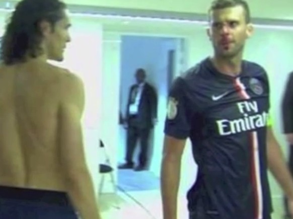 Thiago Motta mit Blut im Gesicht.