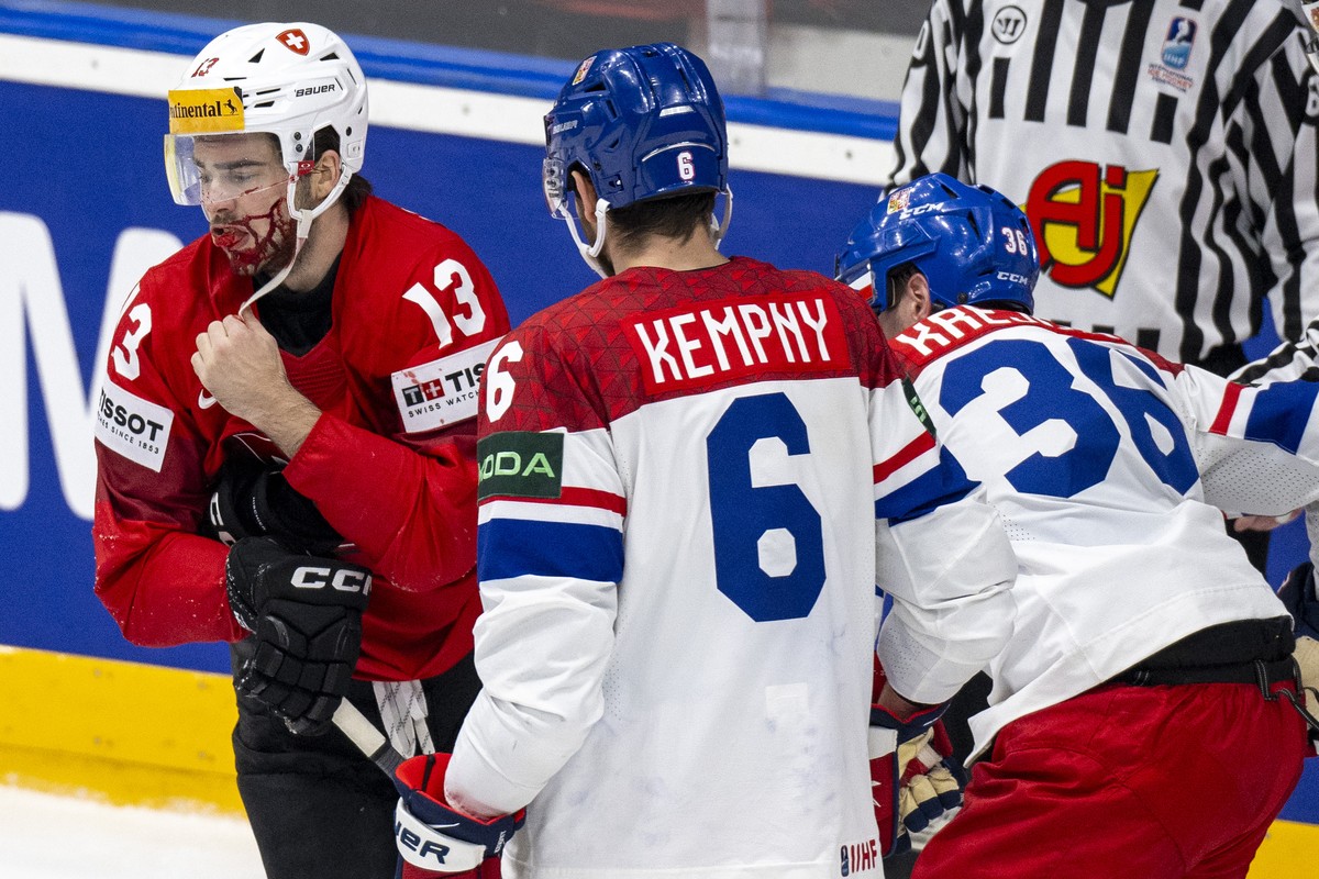 Switzerland's Nico Hischier bleeds during the Ice Hockey World Championship group A preliminary round match between Switzerland and Czech Republic in Prague at the O2 Arena, Czech Republic, on Mo ...