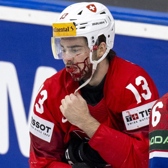 epa11338007 Switzerland&#039;s Nico Hischier bleeds during the preliminary round group A match between Switzerland and Czech Republic at the IIHF Ice Hockey World Championship 2024 in Prague, Czech Re ...