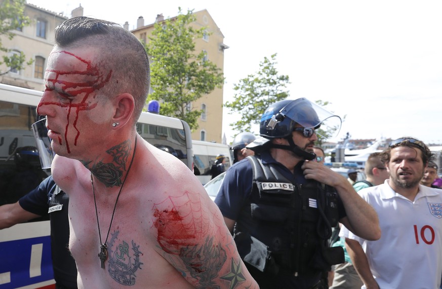 Die Französische Polizei führt einen blutverschmierten Hooligan ab.