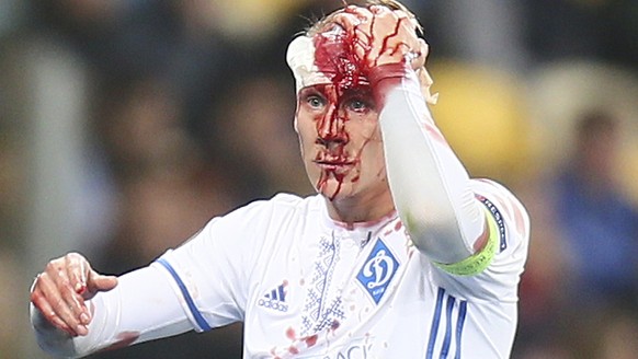 Dynamo Kiev's Domagoj Vida from Croatia leaves the field after being injured during the Group B Europa League soccer match between Dynamo Kiev and Young Boys at the Olympiyskiy stadium in Kiev, Ukrain ...