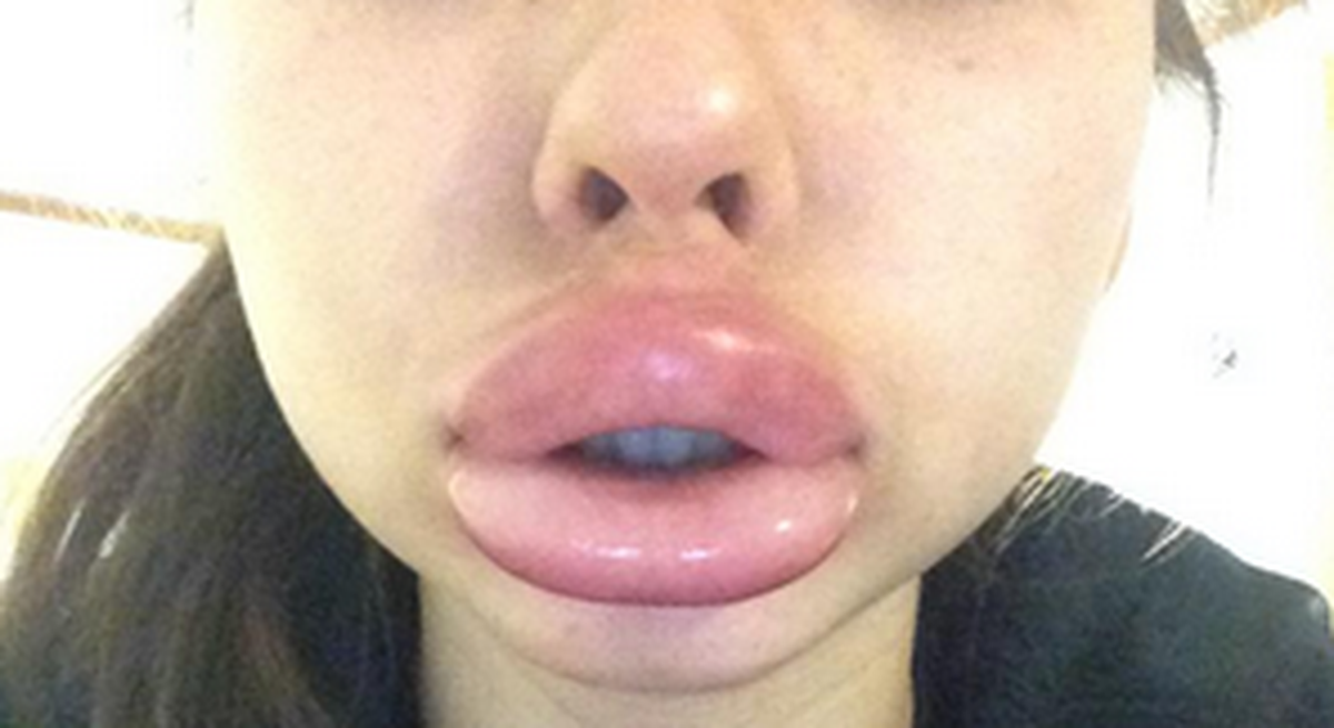 Ist es ein Schlauchboot? Ist es eine Lippe? Man weiss es nicht.