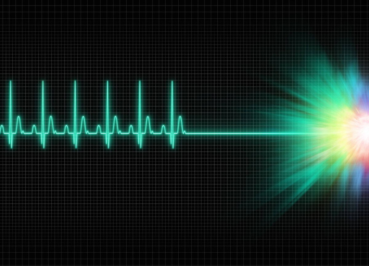 exitus a mystic electrocardiography exitus illustration in dark screen background Copyright: xZoonar.com/AchimxPrillx 8017037