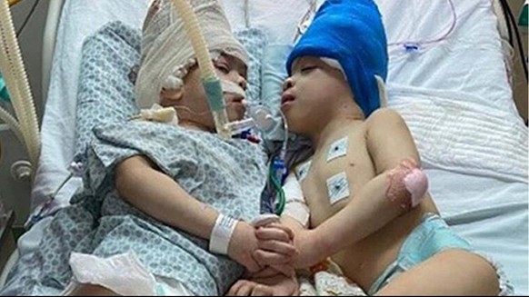 Die beiden Kinder nach der gelungenen Trennung.