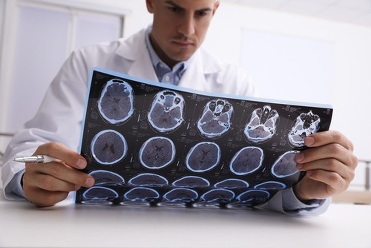 Médecin examinant des images d'IRM d'un patient atteint de sclérose en plaques à la table d'une clinique, en gros plan