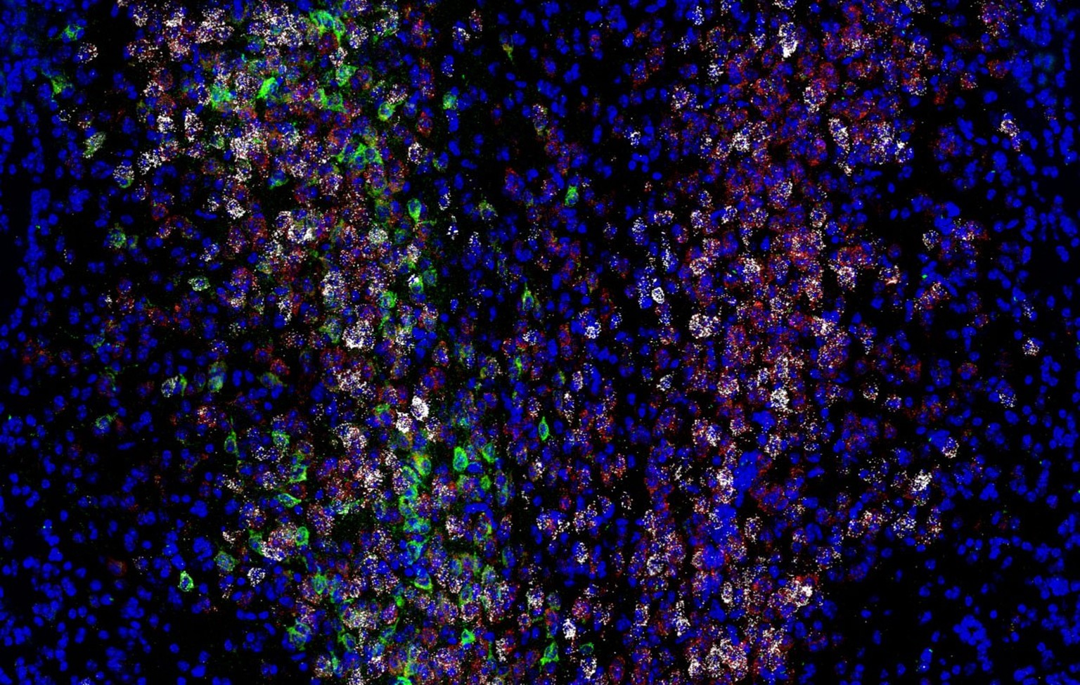 Expression of various genes and proteins (white, red, and green) in neurons amongst mouse brain cells (blue).