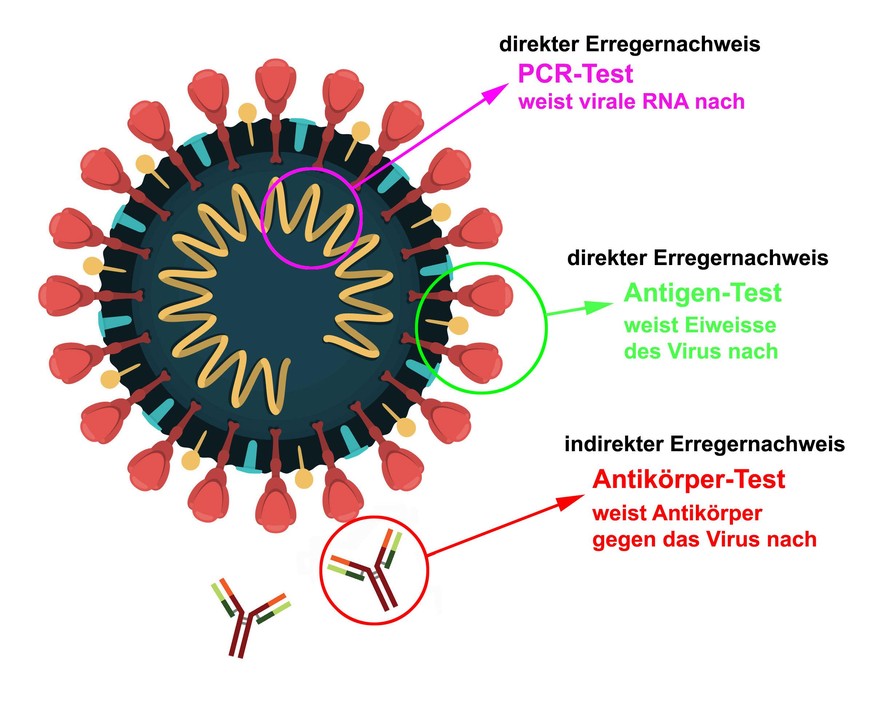 Illustration PCR-Test, Antigen-Test, Antikörper-Test Coronavirus, SARS-CoV-2