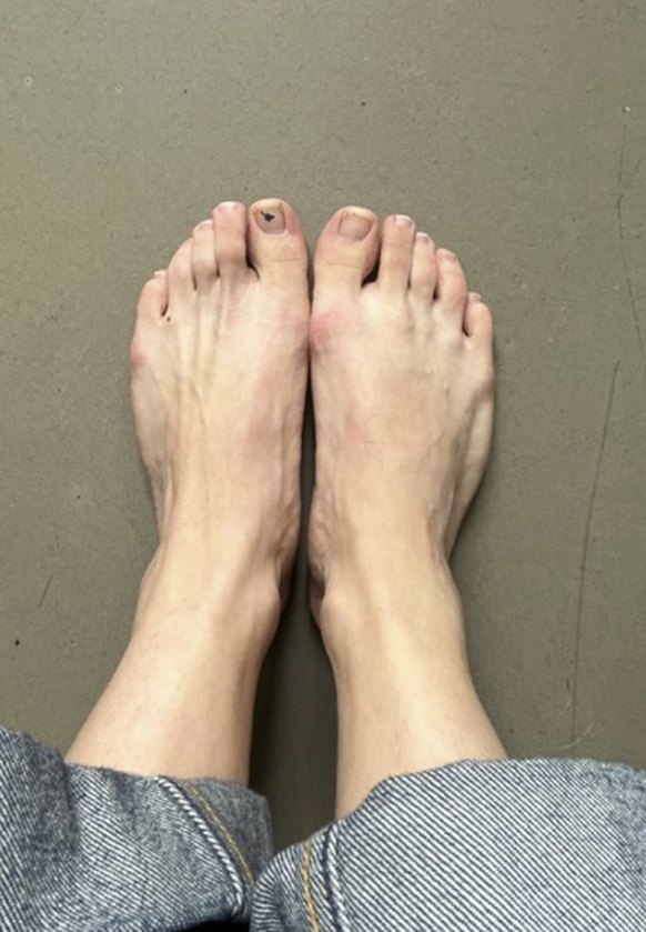 Flipflop oder nicht? das sind die schönsten Watson Füsse