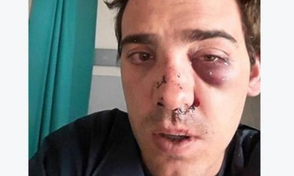 Der 26-jährige Alexandre, angeblich von Taxifahrern verprügelt.
