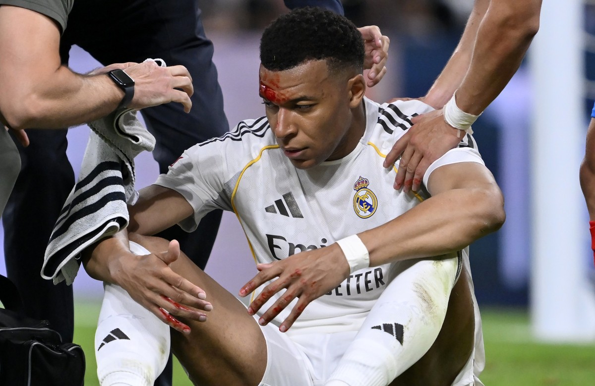 MADRID, SPAIN - APRIL 10: (EDITORS NOTE: Image depicts graphic content) Kylian Mbappe of Real Madrid gets injured during the La Liga Week 31 match between Real Madrid and Girona at Santiago Bernabeu S ...