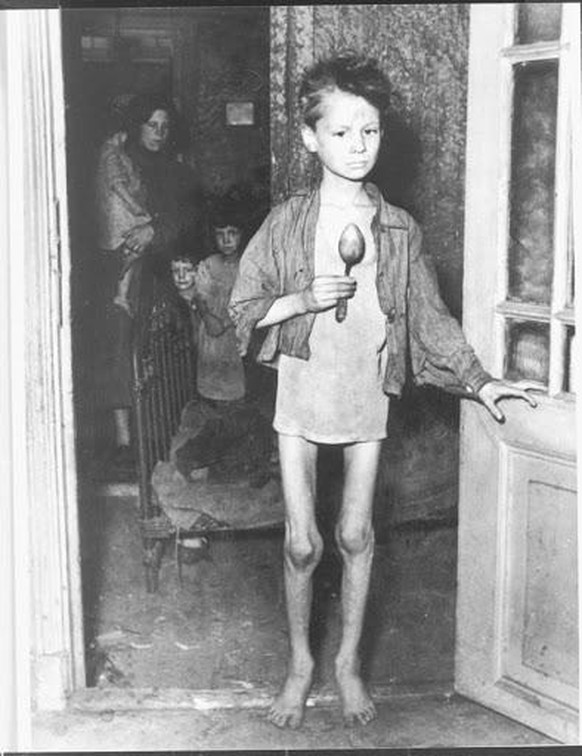 Unterernährter Junge im Hungerwinter. Er überlebte. 