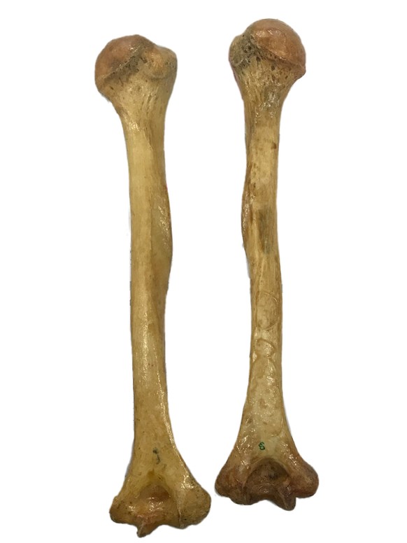 Menschliche Knochen