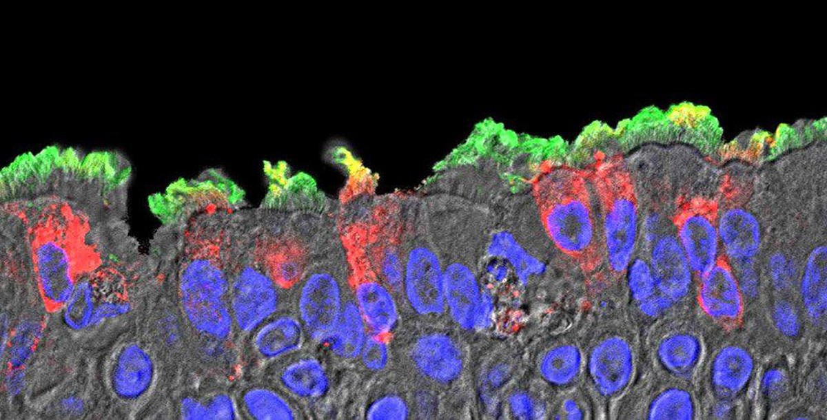 Das Coronavirus befällt vor allem die mit Härchen besetzten Zilienzellen in Nase und Bronchien. (grün: Zilien, rot: infizierte Zilienzellen)