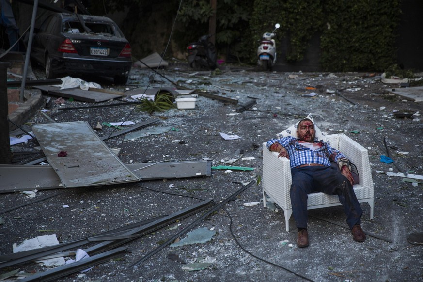 BEIRUT, LEBANON - AUGUST 04: (EDITORS NOTE: Image contains graphic content.) An injured man rests in a chair after a large explosion on August 4, 2020 in Beirut, Lebanon. Video shared on social media ...