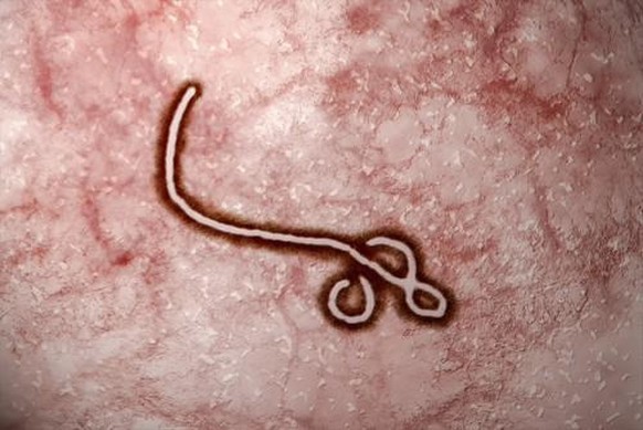 Das Ebola-Virus unter dem Mikroskop.