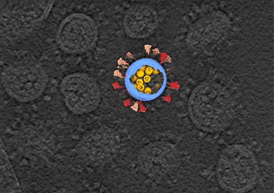 A cryo-electron tomography image of SARS-CoV-2 viruses, in gray, with a computer reconstruction of one virus.
