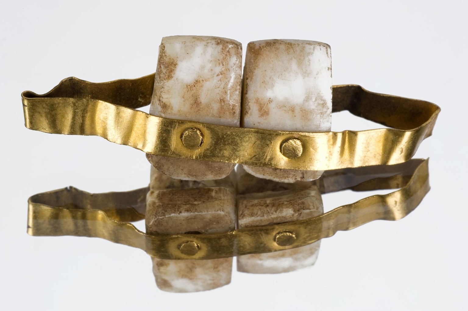 etruskische Zahnersatz mit einem Goldband und eingenieteten Zähnen aus der Zeit um 500 v. Chr.
