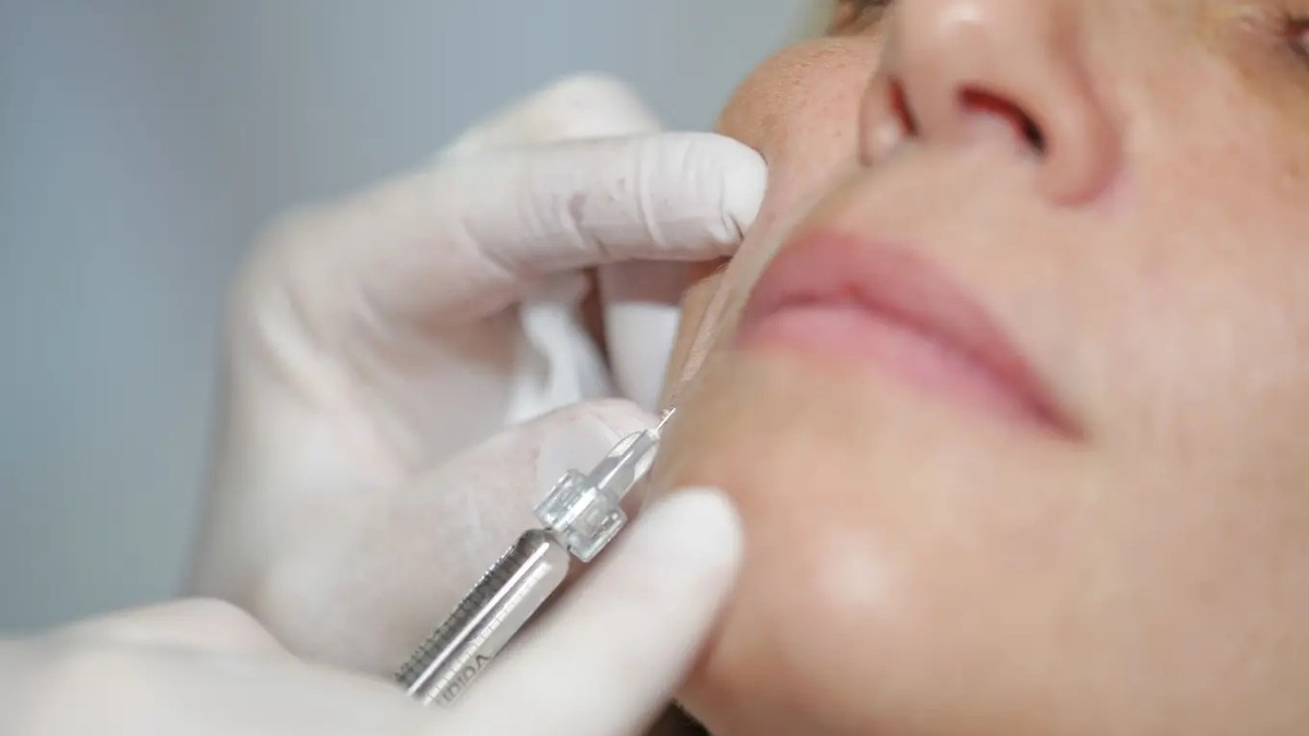 Mit Botox werden die Falten unterspritzt, um jünger auszusehen. Doch mit dem Nervengift ist auch anderes möglich.