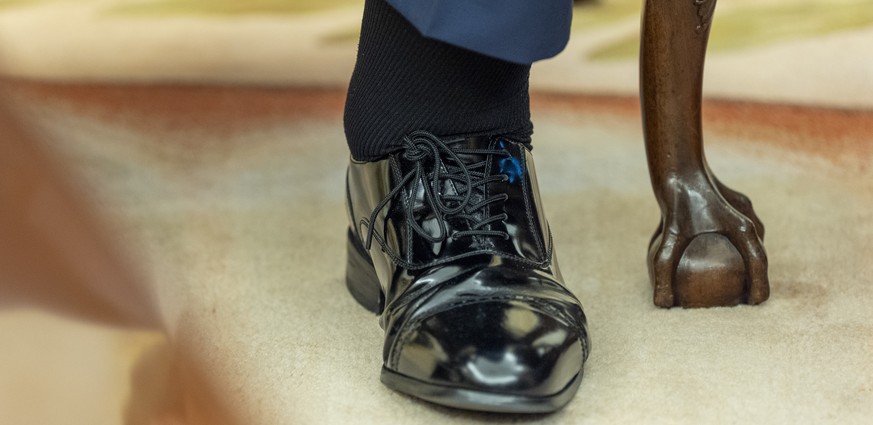 The left foot and swollen ankle of President Donald Trump are pictured as he sits with Bahrain's Crown Prince Salman bin Hamad Al Khalifa in the Oval Office of the White House, Wednesday, July 16 ...