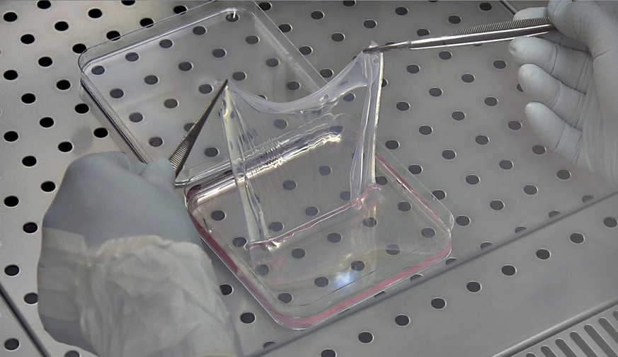 Ein Arzt am Zentrum für regenerative Medizin an der Universität in Modena, Italien, hält eine Hautschicht mit zwei Pinzetten fest. (Symbolbild)