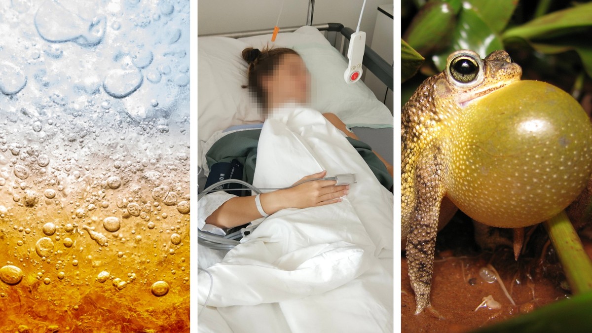 R-CPD: Von der Botoxinjektion zum Rülpsen