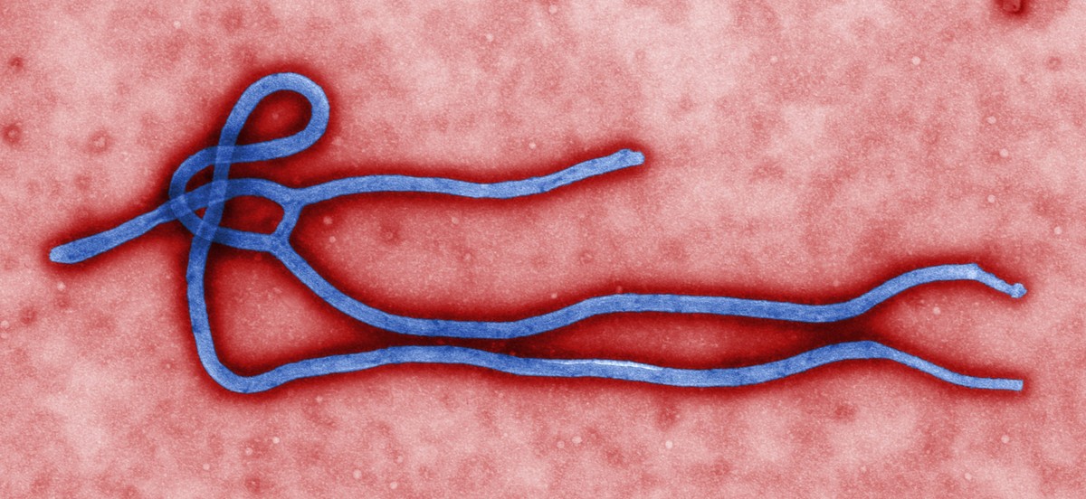 Tödlicher Erreger: Ebola-Virus.