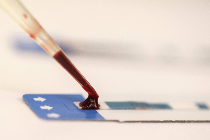 A nurse tests a blood sample during a free HIV test at a blood tests party, part of a campaign to prevent HIV infection among male same-sex couples, in Bangkok September 20, 2014. Bare-chested male mo ...