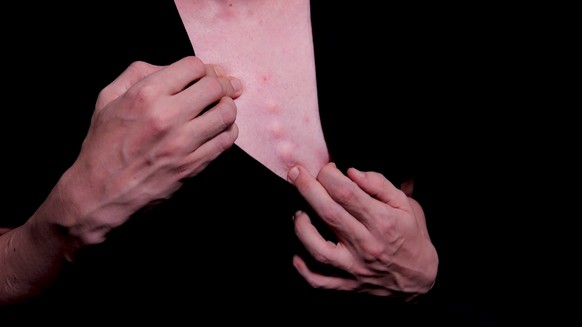 Steve Void modifizierte sich die Brust