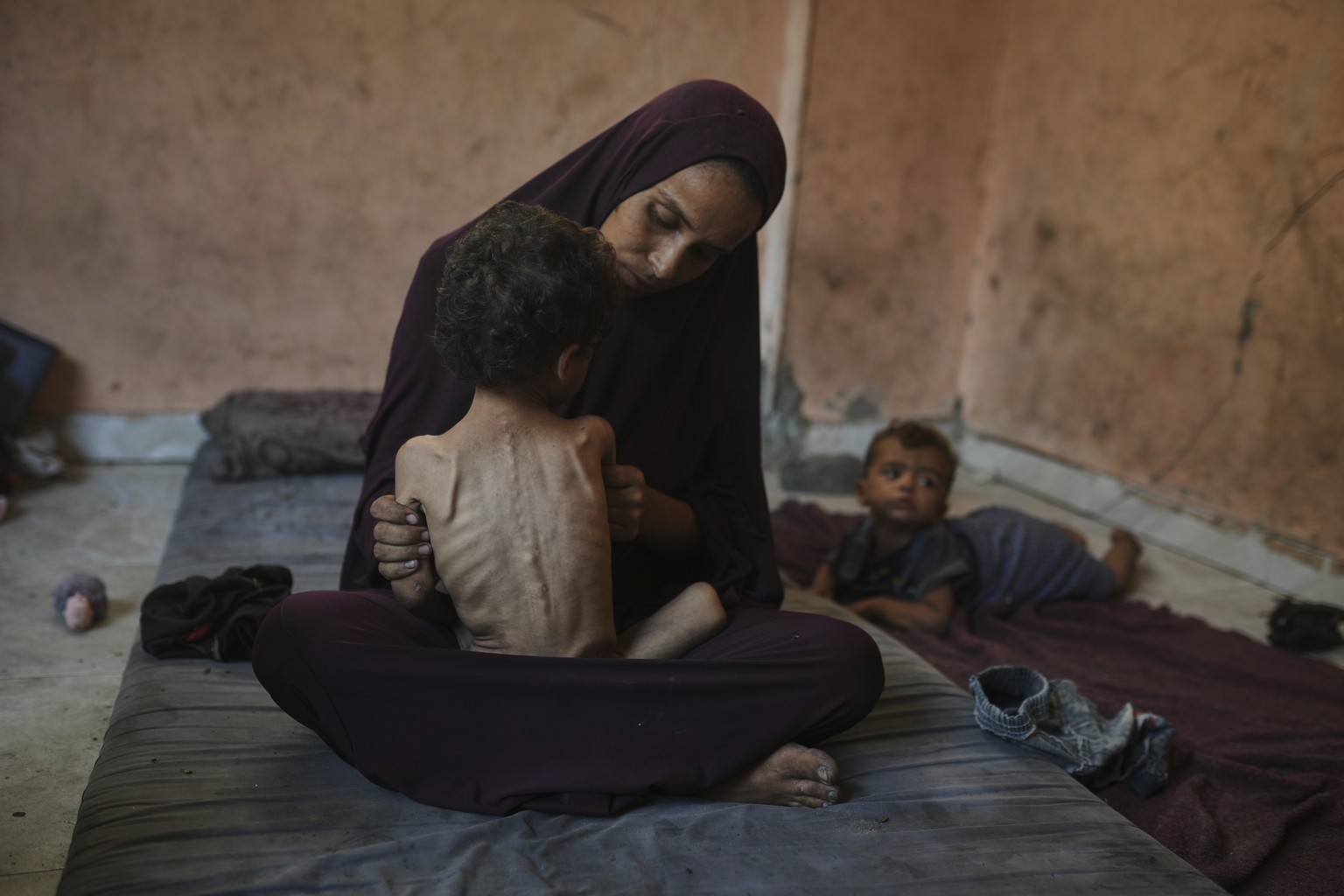 KEYPIX - Naima Abu Ful poses for a photo with her 2-year-old malnourished child, Yazan, at their home in the Shati refugee camp in Gaza City on Wednesday, July 23, 2025. (AP Photo/Jehad Alshrafi)