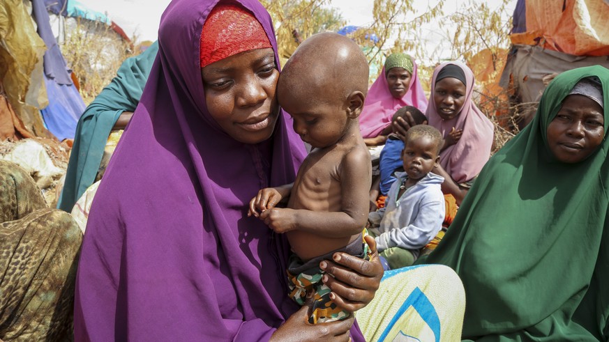Nunay Mohamed, 25, who fled the drought-stricken Lower Shabelle area, holds her one-year old malnourished child at a makeshift camp for the displaced on the outskirts of Mogadishu, Somalia Thursday, J ...