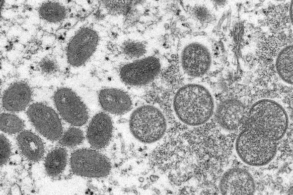 FILE - This 2003 electron microscope image made available by the Centers for Disease Control and Prevention shows mature, oval-shaped monkeypox virions, left, and spherical immature virions, right, ob ...
