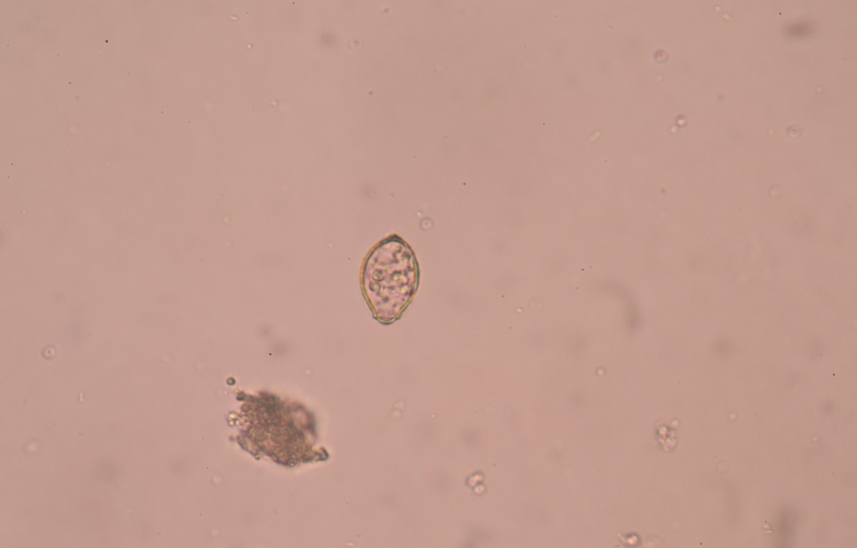 opisthorchis viverrini of egg medical background concept.