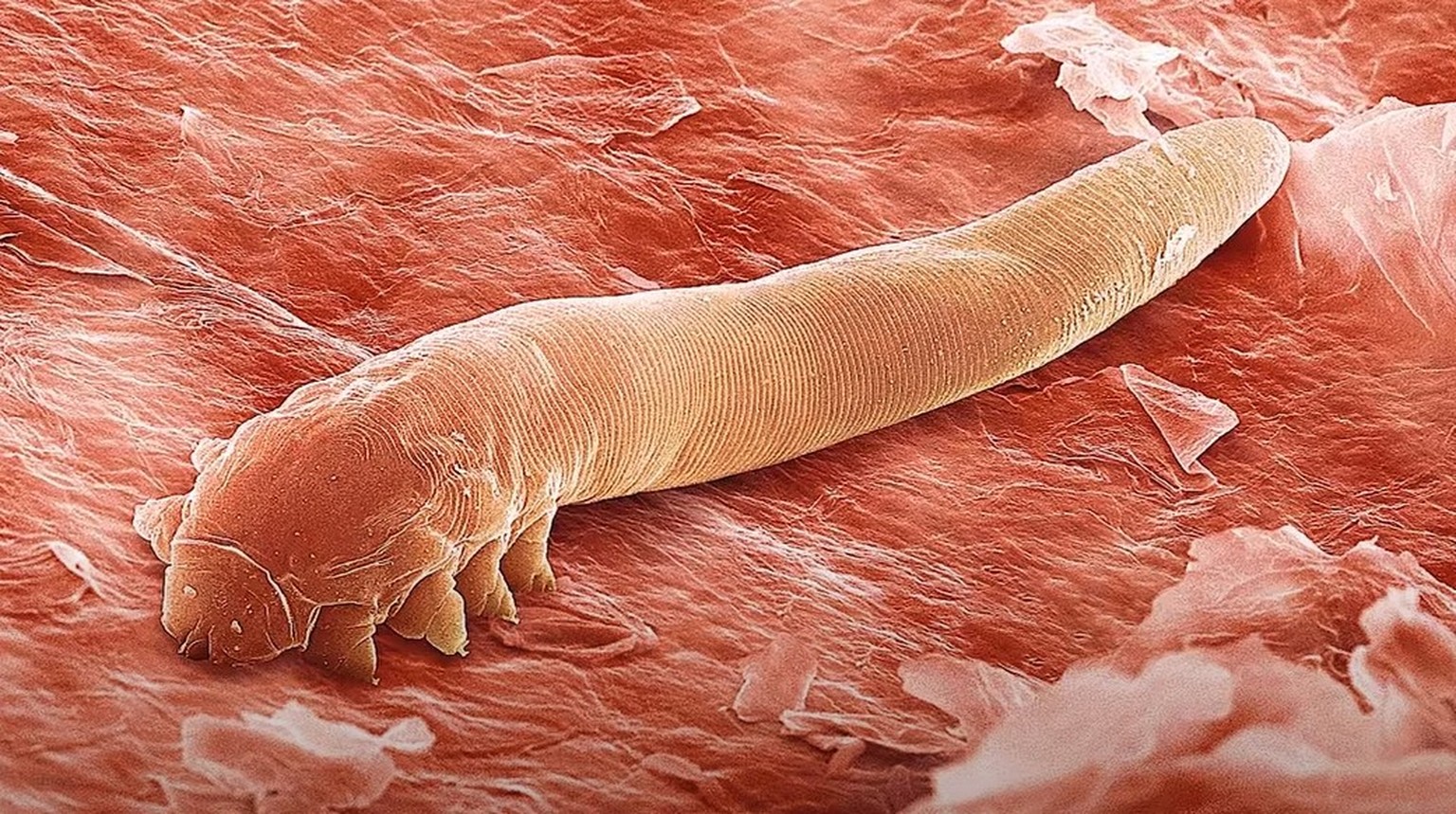 Haarbalgmilbe (Demodex folliculorum)
https://www.youtube.com/watch?v=iKrEYjmKzRc