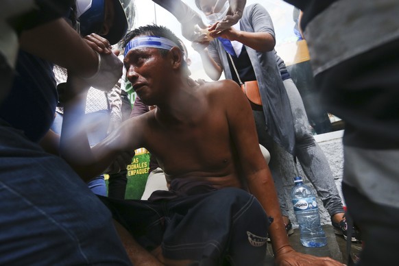An injured demonstrator receives first aid after being injured by a shotgun blast during clashes with the police, as he was protesting against Nicaragua&#039;s President Daniel Ortega, in Managua, Nic ...