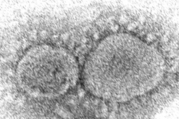 FILE - This 2020 electron microscope image made available by the Centers for Disease Control and Prevention shows SARS-CoV-2 virus particles, which cause COVID-19. A crucial question has eluded govern ...