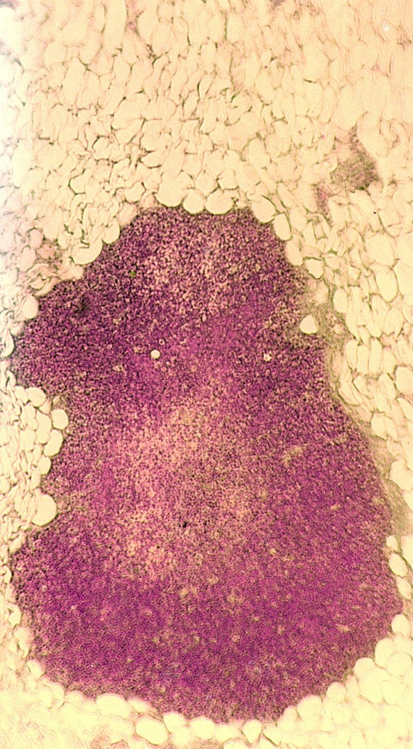 Bei Erwachsenen verkümmert der Thymus und verwandelt sich zusehends in Fettgewebe (die gelblichen Zellen am Rand). 