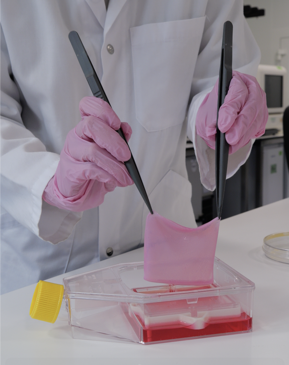 Hoffnung für Brandverletzte: Die im Labor in Schlieren gezüchtete Haut.