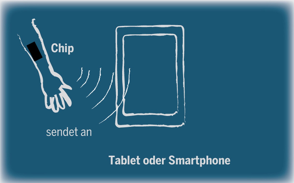 Ein wenige Millimeter langer Chip, der direkt unter der Haut eingesetzt wird, überwacht die Blutwerte. Ein spezielles Pflaster auf dem Körper versorgt den Chip mit Strom und greift die gespeicherten D ...