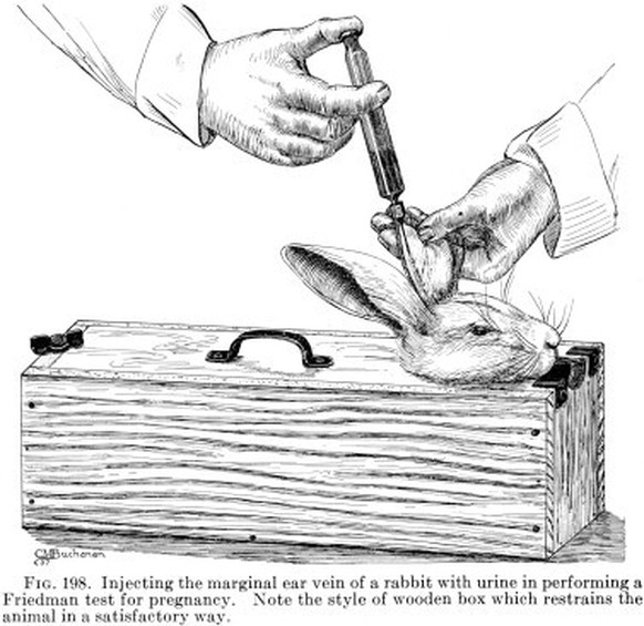 Aus Roy Krackes «Textbook of clinical pathology» (1938).