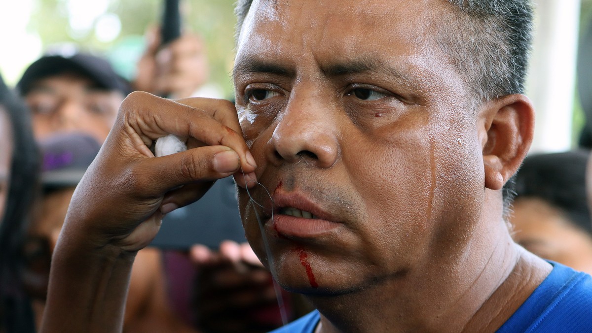 epaselect epa10591652 A migrant has his mouth sewed shut during a protest in Huixtla, Chiapas, Mexico, 25 April 2023. Some members of the 'migrant Stations of the Cross', which is advancing  ...
